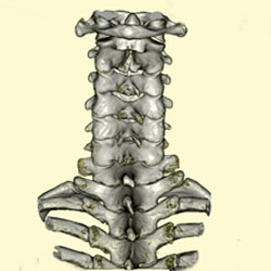 骨を開き、人工骨で固定する方法