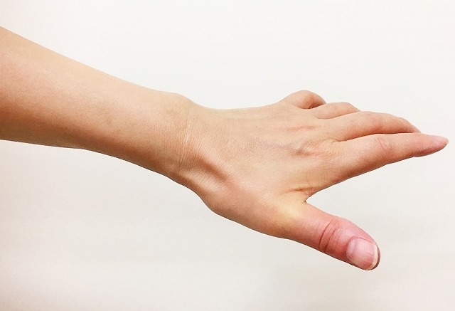 指の痛み・変形