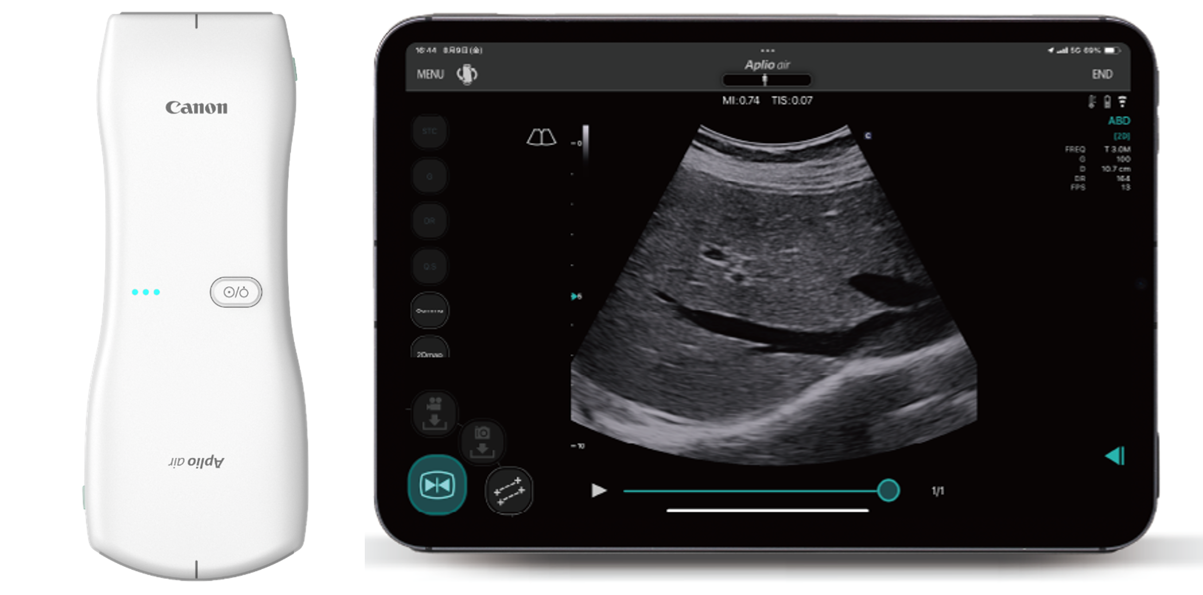 超音波診断装置Aplio Air